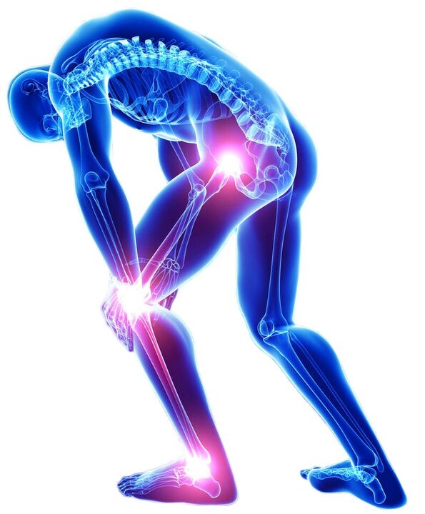درد حاد هنگام حرکت علامت بیماری مفصل است