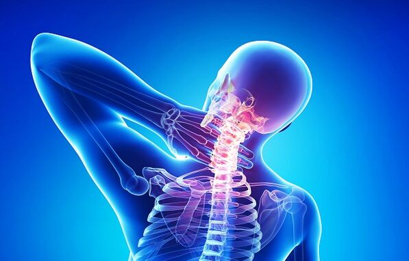 گردن درد همراه با پوکی استخوان
