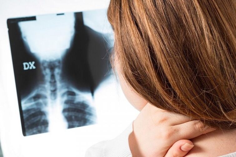 X -ray از منطقه دهانه رحم
