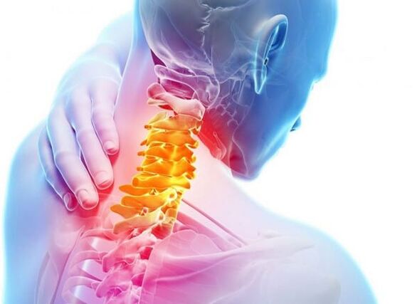 پوکی استخوان ستون فقرات گردن رحم